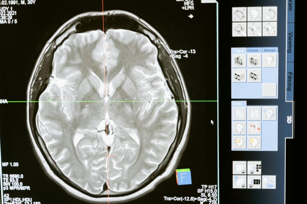 Neurologia