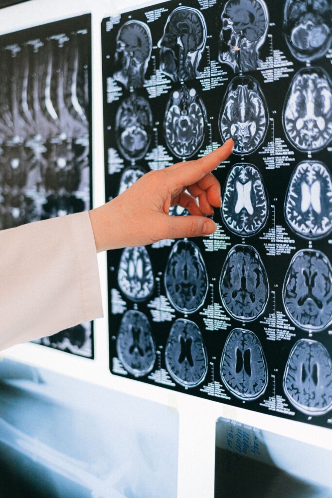 Neurologia