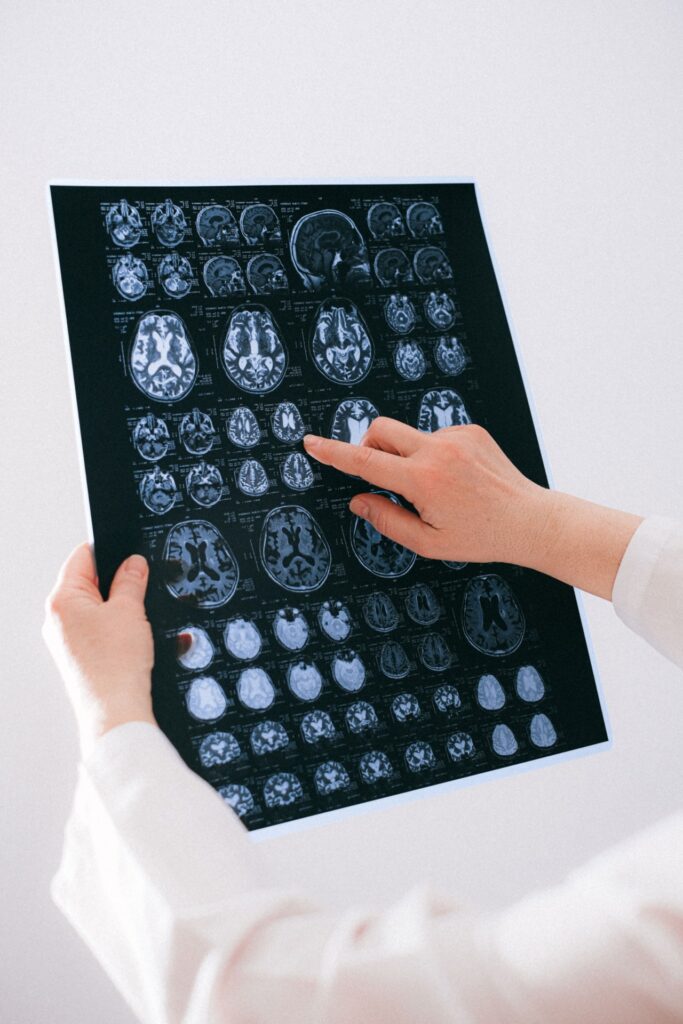 Neurologia